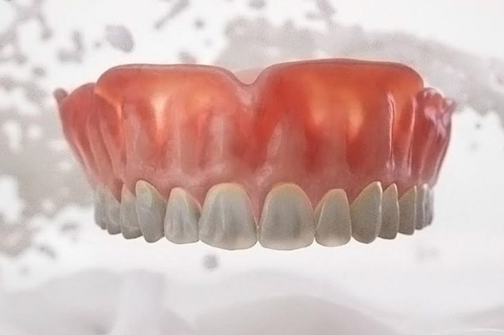 Upper Dentures